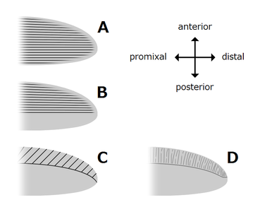 Variations of radiodont body flaps