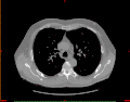 Image import from CT (DICOM)