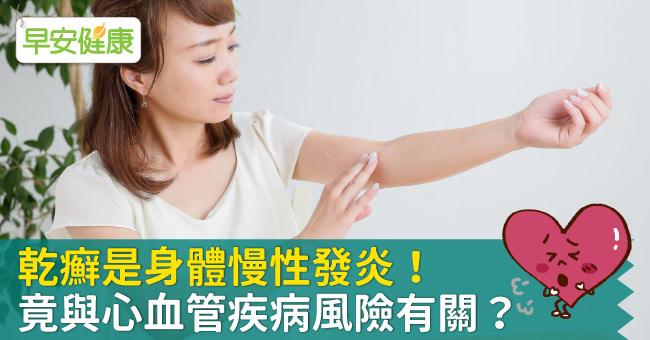 乾癬如何治療與日常保養？醫師根治乾癬9個關鍵解答