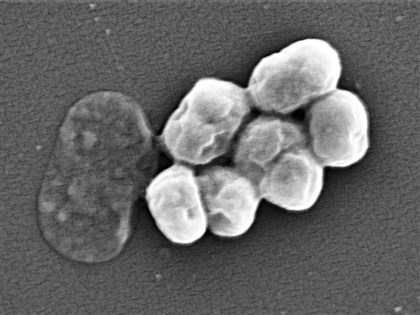 科學家借助AI發現全新抗生素 可對付超級細菌