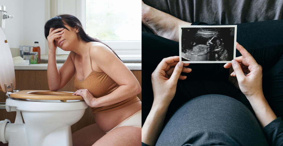 【潮流#tag】懷孕後一直孕吐怎麼辦？9個緩解孕吐的小秘訣 (示意圖/Getty image)