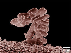 E coli at 10000x.jpg