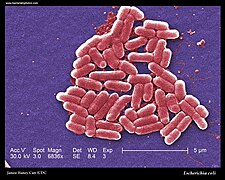 Escherichia coli electron microscopy.jpg