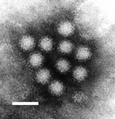 Noroviruksia. Valkoisen palkin pituus kuvassa on 50 nanometriä.