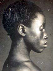 Daguerreotype of Delia, a slave woman on a plantation in Columbia, South Carolina. Delia was an American born slave, daughter of Congo born slave "Renty". (circa 1850–1853)