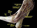 Dissection image. Around the medial malleolus seeing from below.