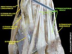 Extensor digitorum muscle