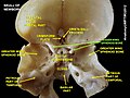 Lesser wing of sphenoid bone