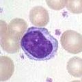 Lymphozyt