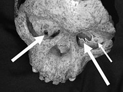 Taung child skull with eagle damage in orbits