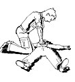 Position pour la CPR : Les bras sont maintenus tendus, les compressions viennent du mouvement des épaules.