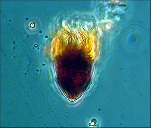 Oligotrich ciliate, probably Strombidium