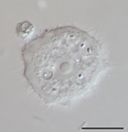 Acanthamoeba sp. (Lobosa: Discosea)