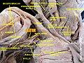 Axillary nerve