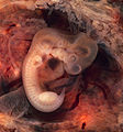 Embryo