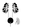 Autosomal dominant polycystic kidney disease