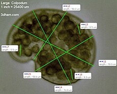 Các phép đo của một Colpodium lớn ở 400x.