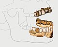 Hitler's mandibular remains were sundered at the alveolar process.