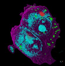 Dact1 organelle in a breast cancer cell