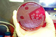 lat. Bacillus anthracis kulturası