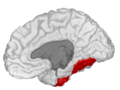 Fusiform gyrus, in the right cerebral hemisphere.