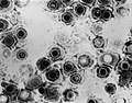 Transmission electron micrograph ning Herpes virus antimong virus a makasuput (enveloped virus) a lupang ebun a piniritu king negative stain electron microscopy.