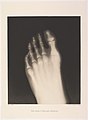 Кеше аяҡ бармаҡтарының рентген һүрәте (фото Эдуард Валента)