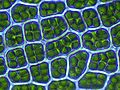 Cellule vegetali, con i cloroplasti all'interno