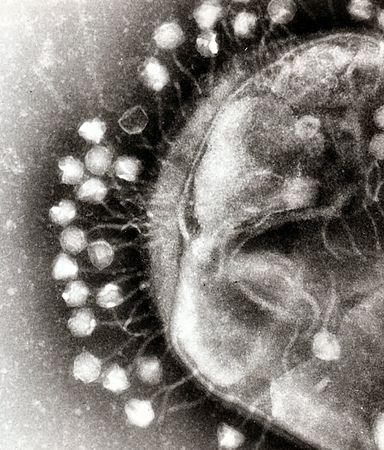 Bacteriophages attached to a bacterial cell wall (created and nominated by Graham Beards)