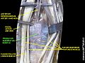 Pronator quadratus muscle