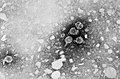 Virusi Hepatiti B