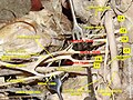 Brachial plexus and common carotid artery