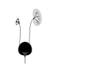 Cystic dysplasia - can affect one or both kidneys