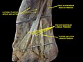 Muscles of the sole of the foot.