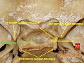 Base of skull - Sella turcica, tuberculum sellae and hypophyseal fossa