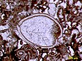 Image 6Articulated ostracod valves in cross-section from the Permian of central Texas; typical thin section view of an ostracod fossil (from Ostracod)