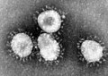 Deng Coronavirus metung lang uri da reng virus a maki halo (sinag), o itsurang balamu korona king lalam ning microscope.