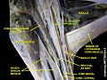 Axillary artery