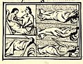 Image 20Depiction of smallpox in Franciscan Bernardino de Sahagún's history of the conquest of Mexico, Book XII of the Florentine Codex, from the defeated Aztecs' point of view (from History of medicine)
