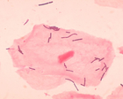 Lactobacillus, isang uri ng Asporohenong Positibong Hugis Rod na Bakterya