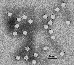 Virus elektronimikroskoopissa