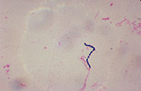חיידקי Streptococcus, סוג המשתייך למערכת ה-Firmicutes