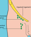 A view of the different inguinal lymph nodes