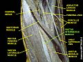 Vastus intermedius muscle