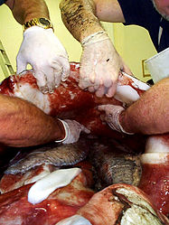 (?/?/1999) A view into the specimen's mantle cavity. The paired, grey ctenidia (gills) are clearly visible.