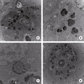 Parasitism and the Vitelline Membrane