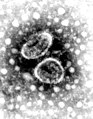 Torovirus. Metung a RNA virus a enveloped (maki súput).