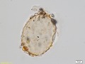 Test of Amphitrema, a testate amoeba recently included in the group