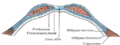 Diagram of sheath of rectus abdominis