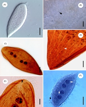 Protoopalina pingi (Opalinidae)